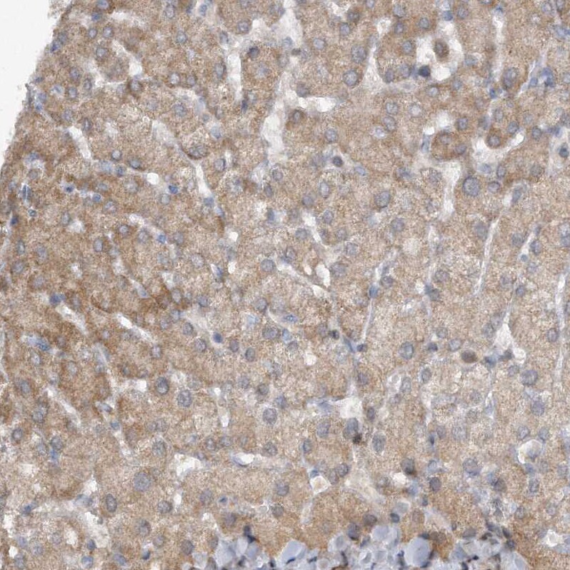 PGBD2 Antibody - BSA Free Immunohistochemistry-Paraffin: PGBD2 Antibody - BSA Free [NBP1-86349]