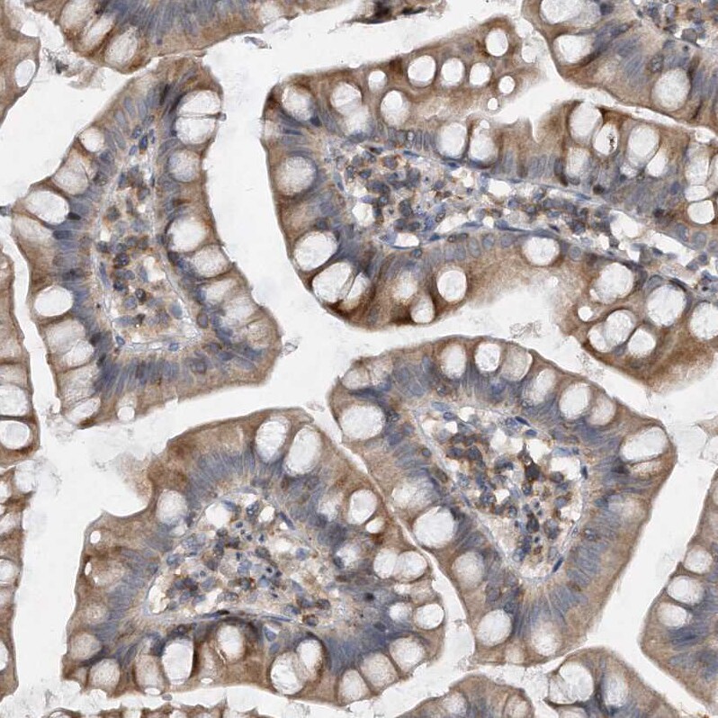PGBD2 Antibody - BSA Free Immunohistochemistry-Paraffin: PGBD2 Antibody - BSA Free [NBP1-86349]