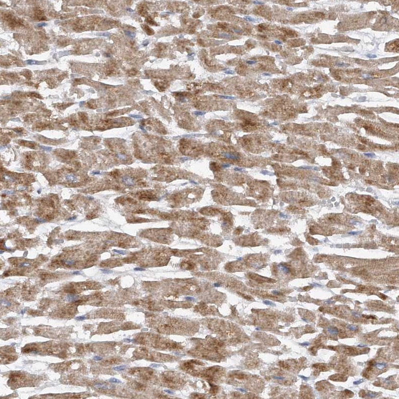 PGBD2 Antibody - BSA Free Immunohistochemistry-Paraffin: PGBD2 Antibody - BSA Free [NBP1-86349]