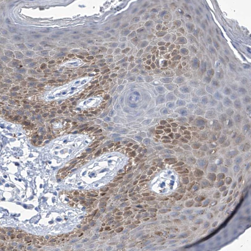 IMPA2 Antibody - BSA Free Immunohistochemistry-Paraffin: IMPA2 Antibody - BSA Free [NBP1-86352]