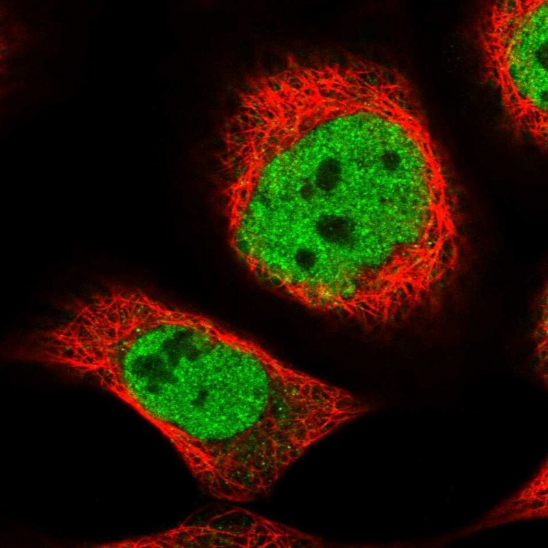 ZNF789 Antibody - BSA Free Immunocytochemistry/ Immunofluorescence: ZNF789 Antibody [NBP1-86354]