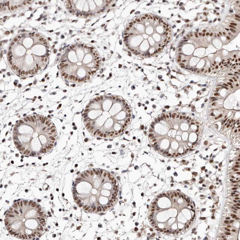 BICRAL Antibody - BSA Free Immunohistochemistry-Paraffin: BICRAL Antibody - BSA Free [NBP1-86360]