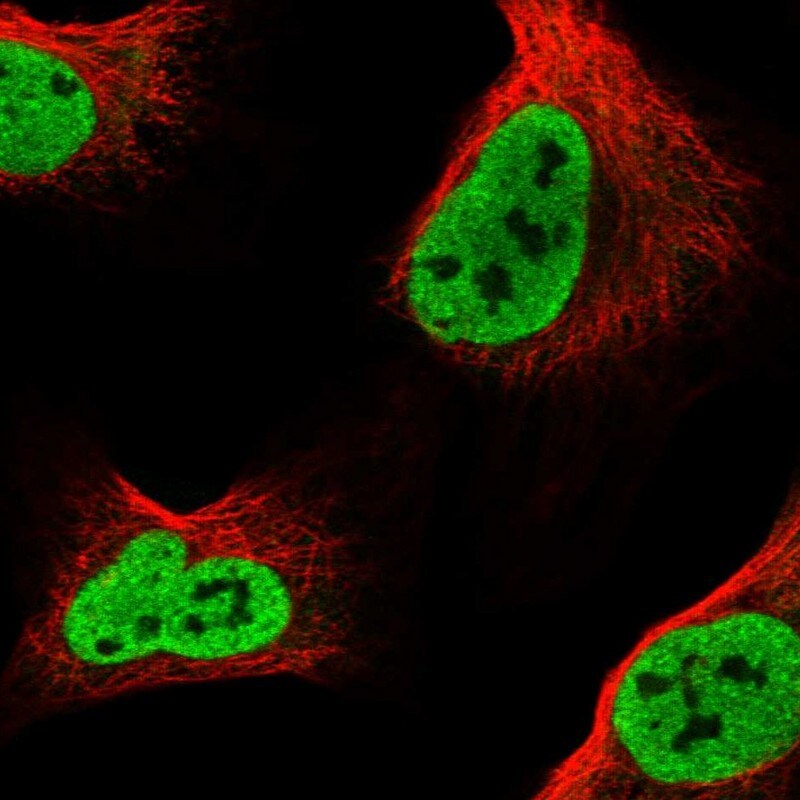 BICRAL Antibody - BSA Free Immunohistochemistry-Paraffin: BICRAL Antibody - BSA Free [NBP1-86360]