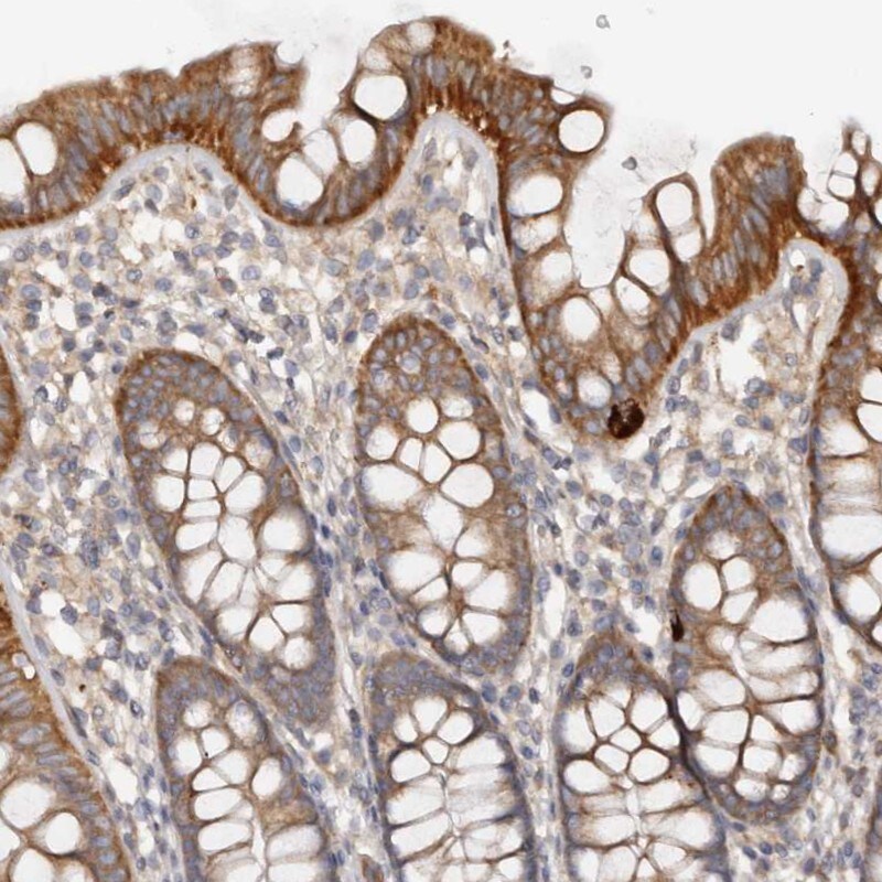 DMRT2 Antibody - BSA Free Immunohistochemistry-Paraffin: DMRT2 Antibody - BSA Free [NBP1-86361]