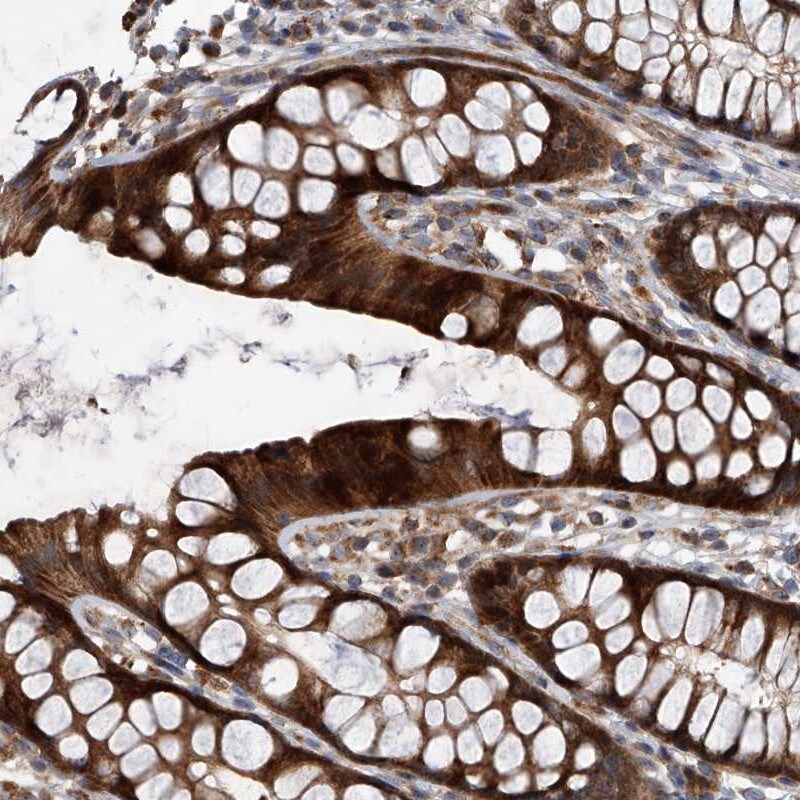 USP47 Antibody - BSA Free Immunohistochemistry-Paraffin: USP47 Antibody [NBP1-86362]