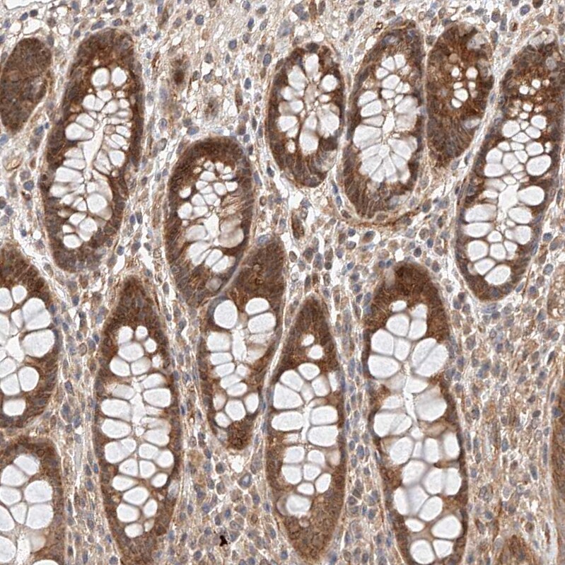 RAB23 Antibody - BSA Free Immunohistochemistry-Paraffin: RAB23 Antibody - BSA Free [NBP1-86366]