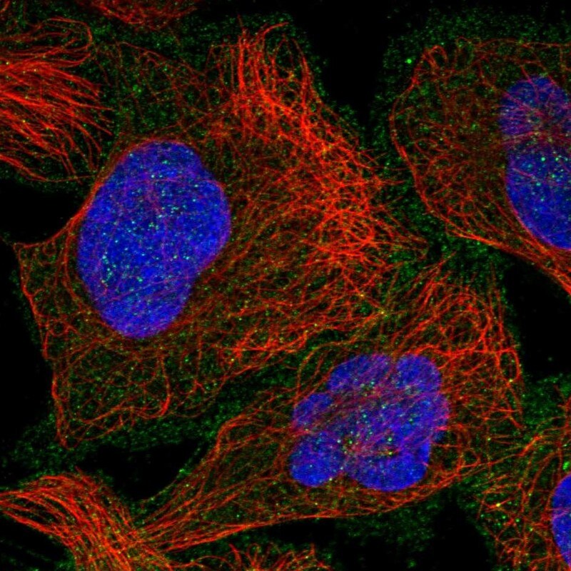 RAB23 Antibody - BSA Free Immunocytochemistry/ Immunofluorescence: RAB23 Antibody [NBP1-86367]