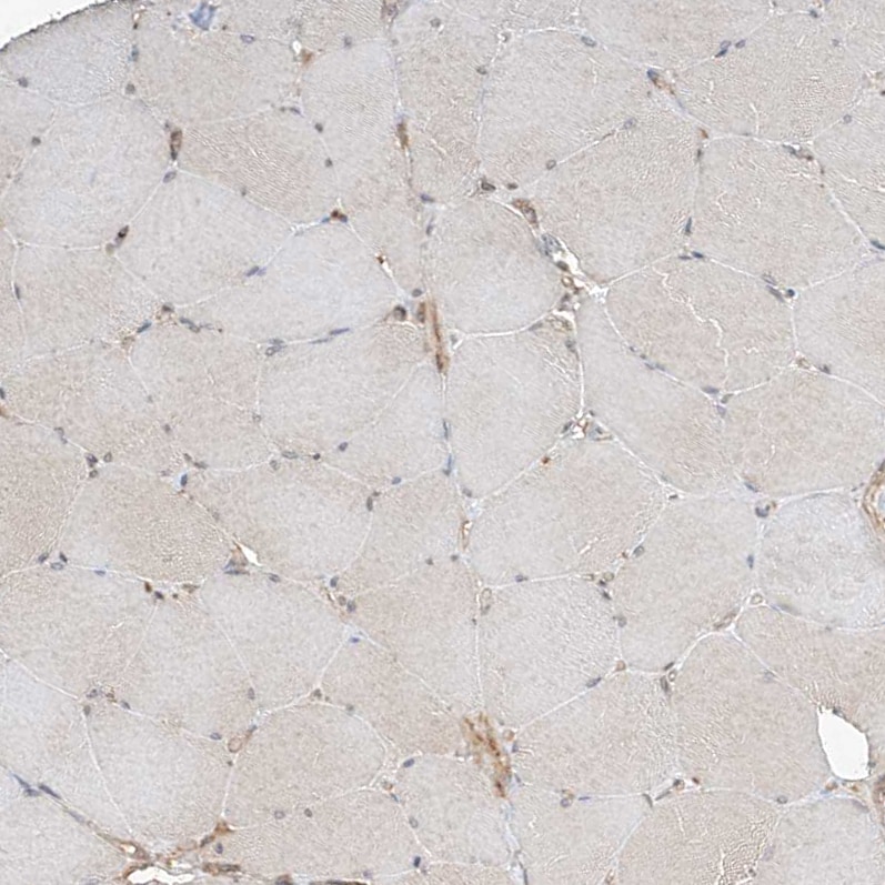 CSMD3 Antibody - BSA Free Immunohistochemistry-Paraffin: CSMD3 Antibody [NBP1-86371]