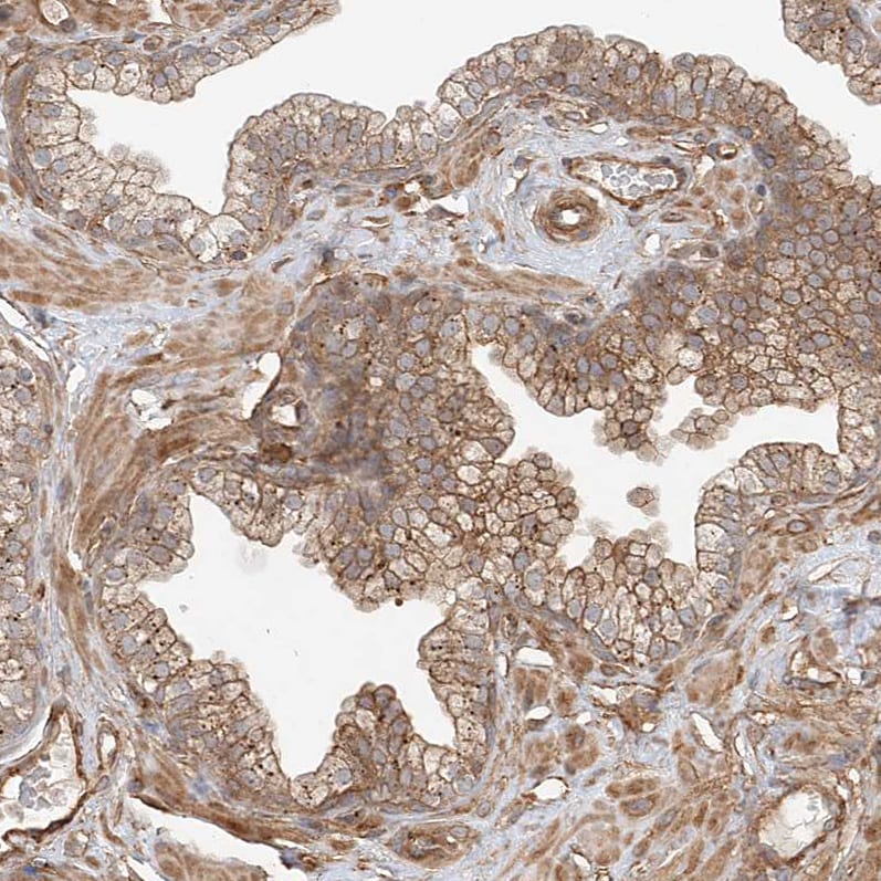 CSMD3 Antibody - BSA Free Immunohistochemistry-Paraffin: CSMD3 Antibody [NBP1-86371]