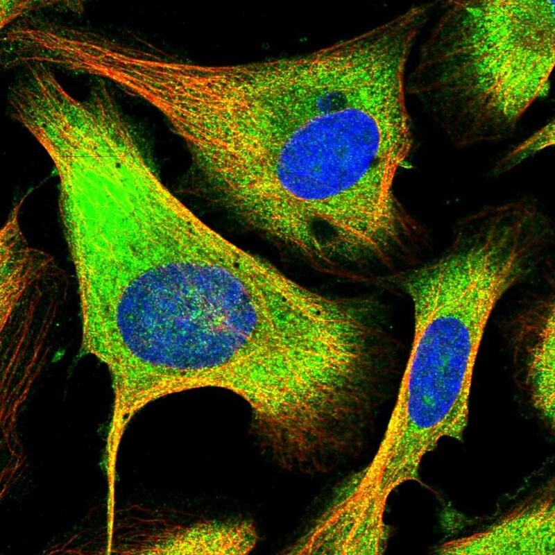 PFDN2 Antibody - BSA Free Immunocytochemistry/ Immunofluorescence: PFDN2 Antibody [NBP1-86378]