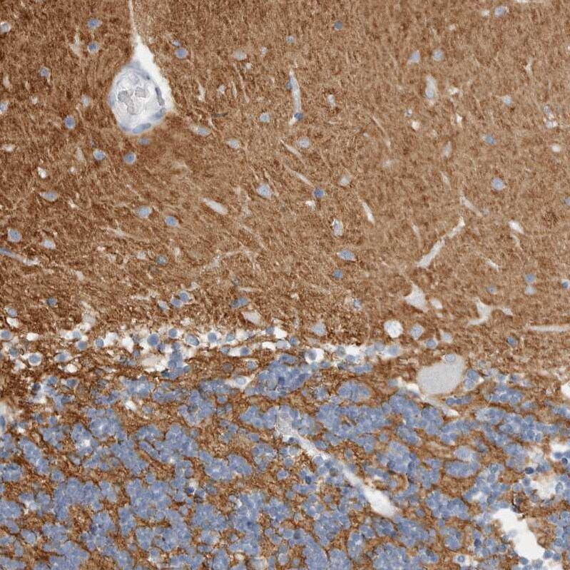 Tenascin R Antibody - BSA Free Immunohistochemistry-Paraffin: Tenascin R Antibody - BSA Free [NBP1-86399]
