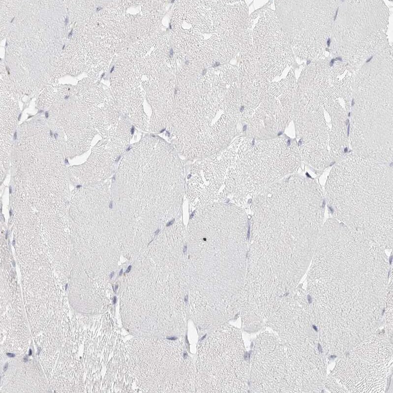 Tenascin R Antibody - BSA Free Immunohistochemistry-Paraffin: Tenascin R Antibody - BSA Free [NBP1-86399]