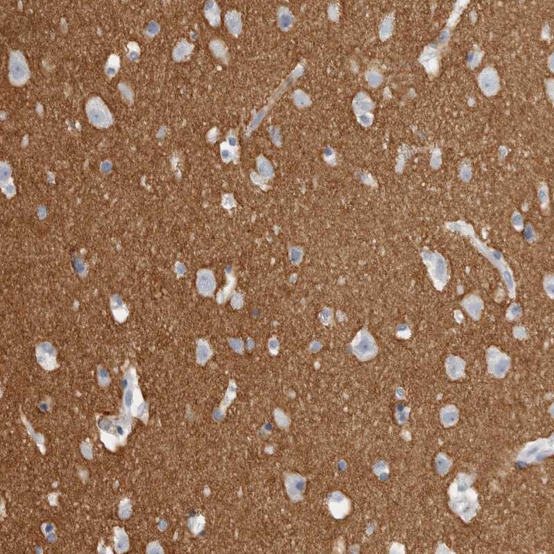 Tenascin R Antibody - BSA Free Immunohistochemistry-Paraffin: Tenascin R Antibody - BSA Free [NBP1-86399]