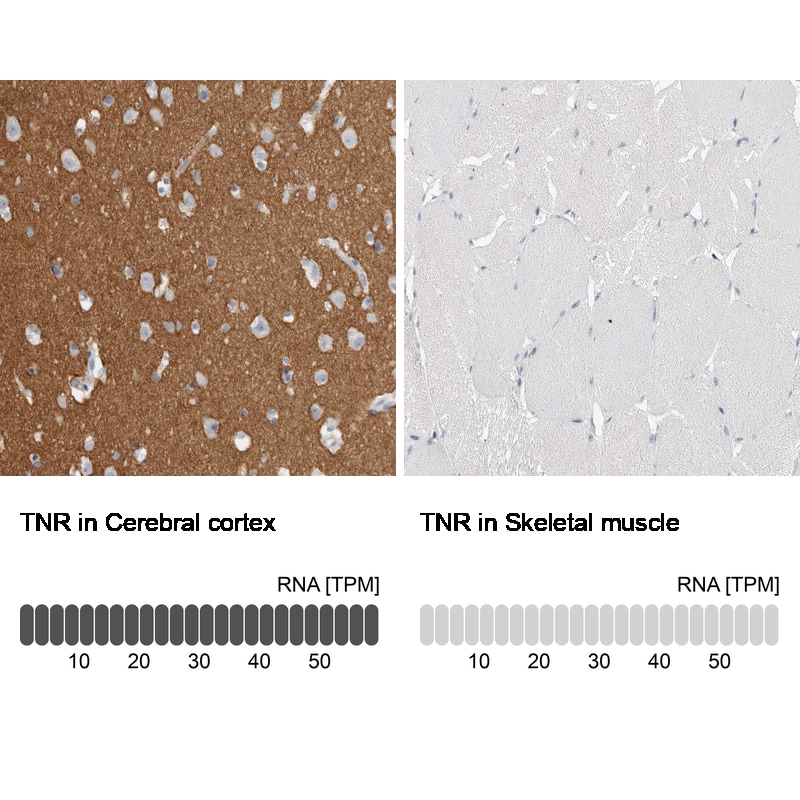 Tenascin R Antibody - BSA Free Immunohistochemistry-Paraffin: Tenascin R Antibody - BSA Free [NBP1-86399]