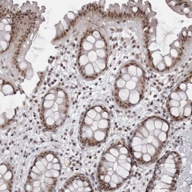 PHF3 Antibody - BSA Free Immunohistochemistry-Paraffin: PHF3 Antibody - BSA Free [NBP1-86407]