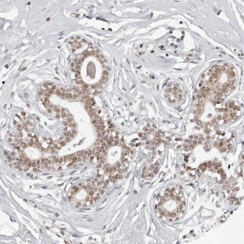 PHF3 Antibody - BSA Free Immunohistochemistry-Paraffin: PHF3 Antibody - BSA Free [NBP1-86407]