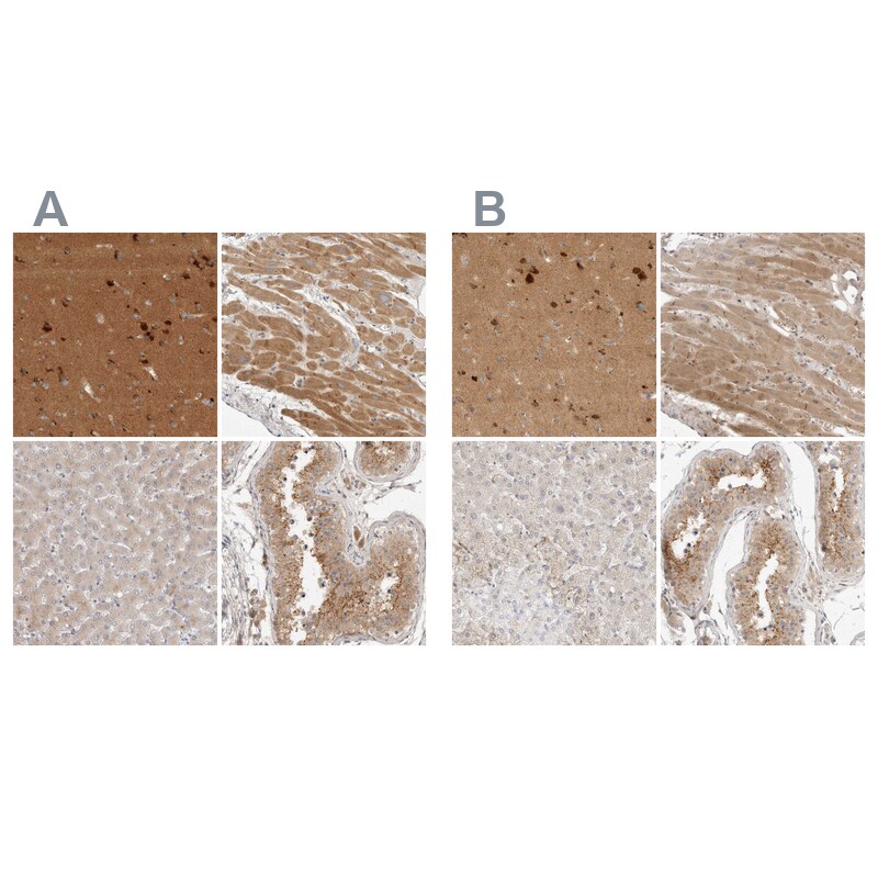 TOM1L2 Antibody - BSA Free Immunohistochemistry-Paraffin: TOM1L2 Antibody - BSA Free [NBP1-86414]
