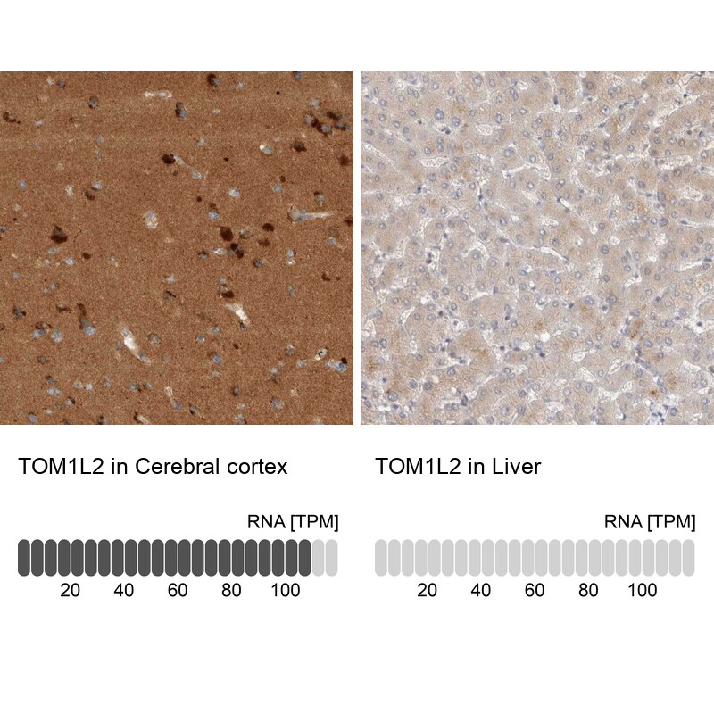 TOM1L2 Antibody - BSA Free Immunohistochemistry-Paraffin: TOM1L2 Antibody - BSA Free [NBP1-86414]