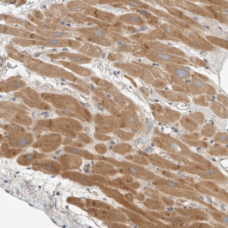 TOM1L2 Antibody - BSA Free Immunohistochemistry-Paraffin: TOM1L2 Antibody - BSA Free [NBP1-86414]