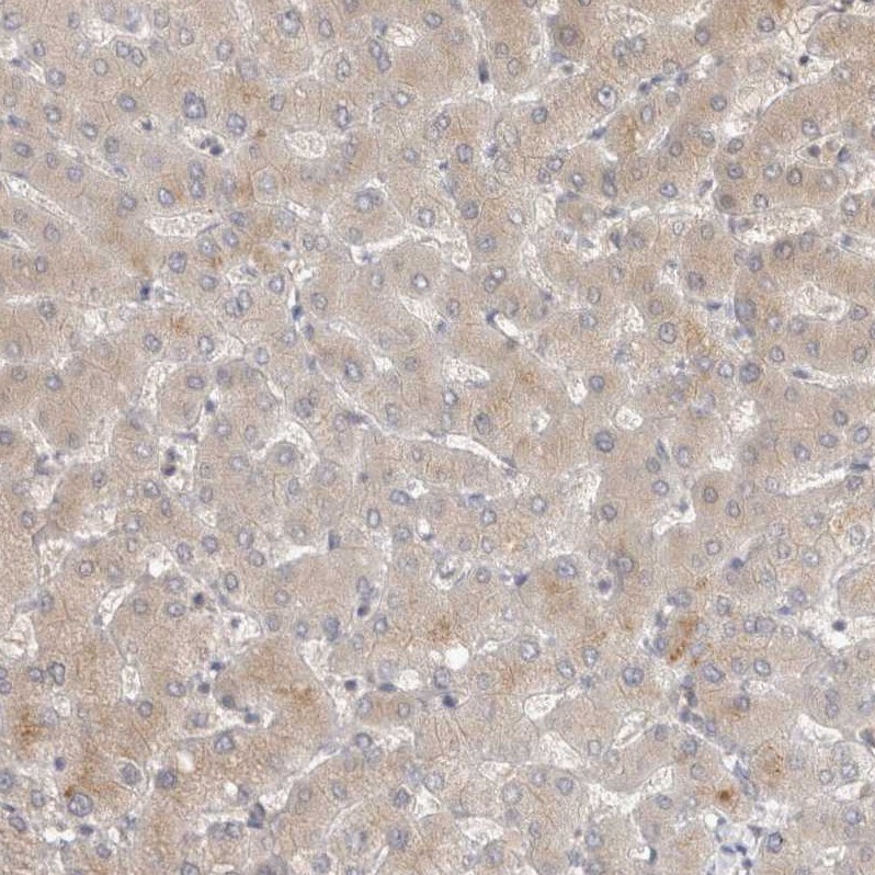 TOM1L2 Antibody - BSA Free Immunohistochemistry-Paraffin: TOM1L2 Antibody - BSA Free [NBP1-86414]