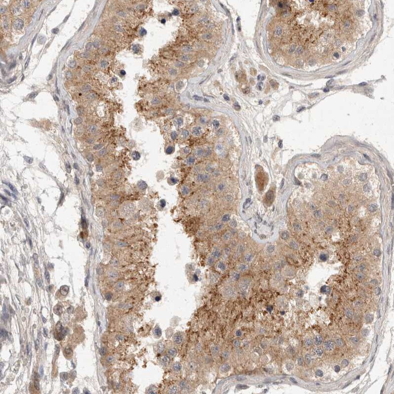 TOM1L2 Antibody - BSA Free Immunohistochemistry-Paraffin: TOM1L2 Antibody - BSA Free [NBP1-86414]