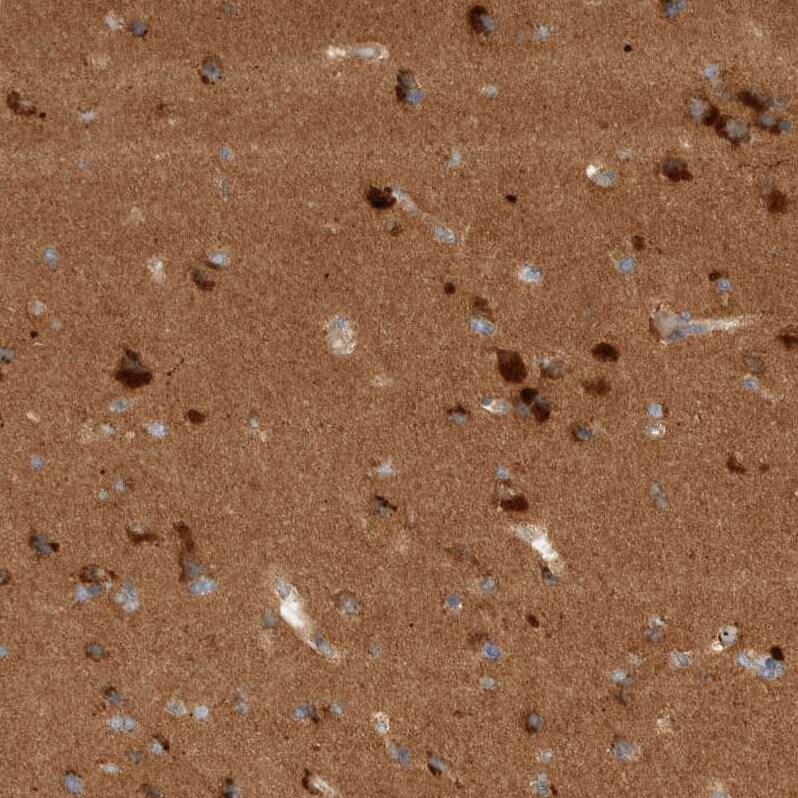 TOM1L2 Antibody - BSA Free Immunohistochemistry-Paraffin: TOM1L2 Antibody - BSA Free [NBP1-86414]
