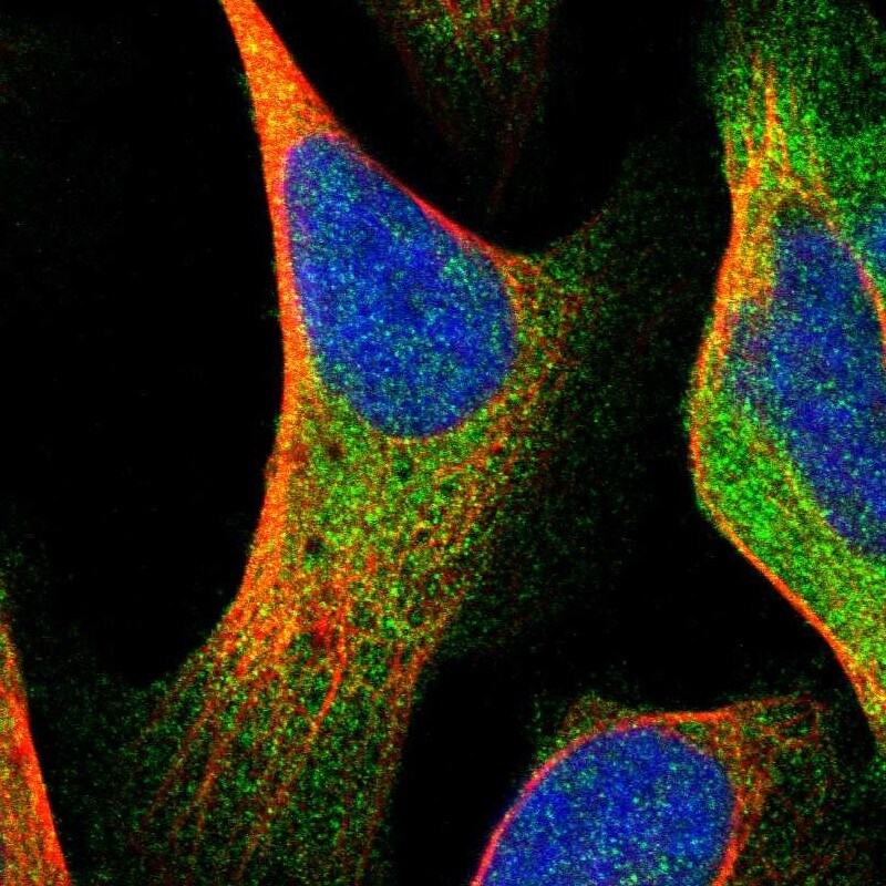 ASMTL Antibody - BSA Free Immunohistochemistry-Paraffin: ASMTL Antibody - BSA Free [NBP1-86420]