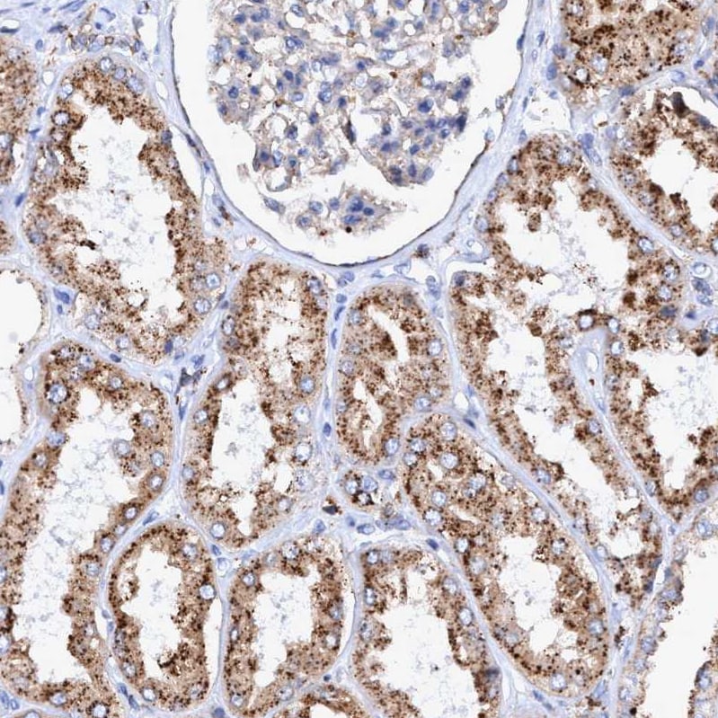 TRIM65 Antibody - BSA Free Immunohistochemistry-Paraffin: TRIM65 Antibody - BSA Free [NBP1-86423]
