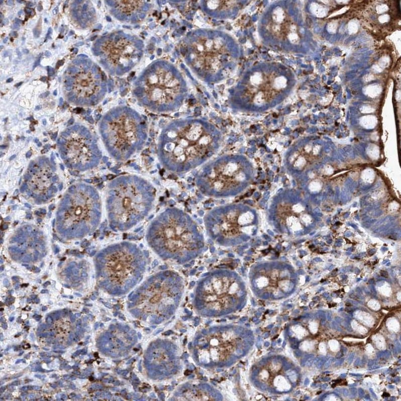 TRIM65 Antibody - BSA Free Immunohistochemistry-Paraffin: TRIM65 Antibody - BSA Free [NBP1-86423]