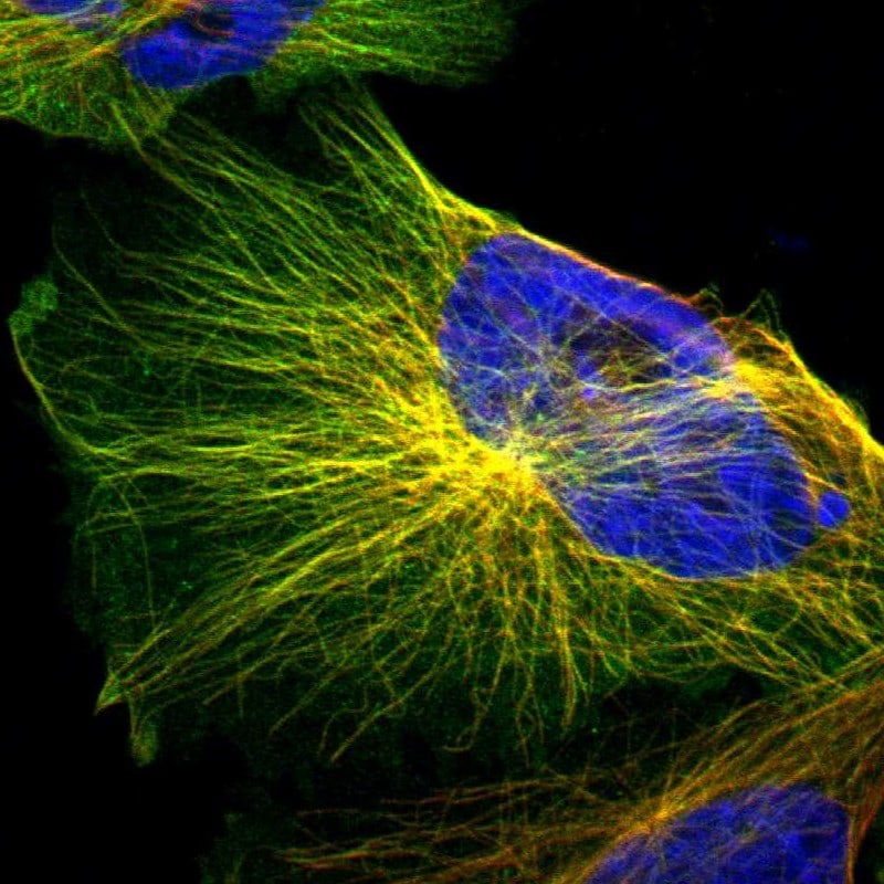 IFT20 Antibody - BSA Free Immunocytochemistry/ Immunofluorescence: IFT20 Antibody [NBP1-86424]