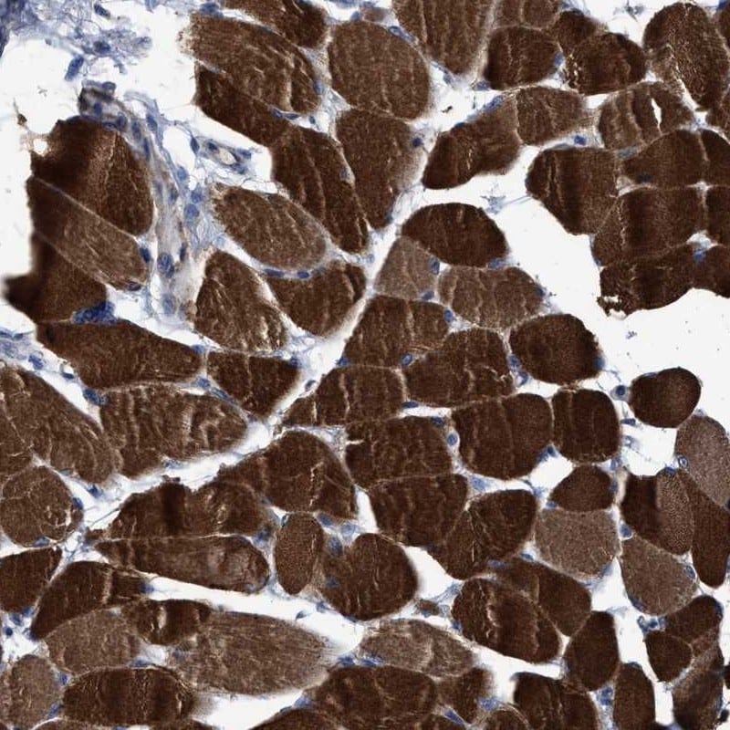 USP29 Antibody - BSA Free Immunohistochemistry: USP29 Antibody - BSA Free [NBP1-86425]