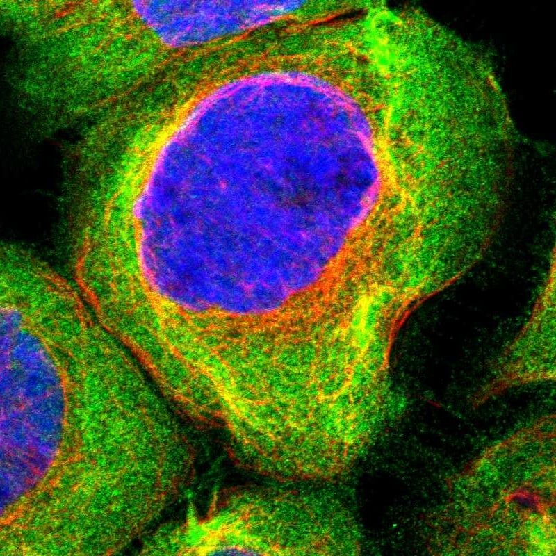BAG3 Antibody - BSA Free Immunohistochemistry-Paraffin: BAG3 Antibody - BSA Free [NBP1-86429]