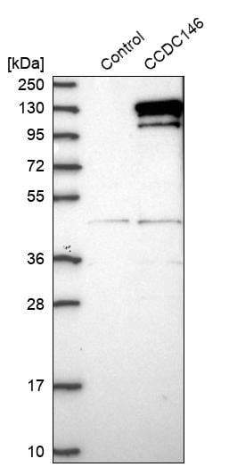 CCDC146 Antibody - BSA Free Western Blot: CCDC146 Antibody - BSA Free [NBP1-86432]