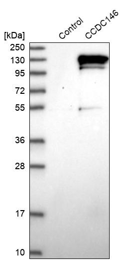 CCDC146 Antibody - BSA Free Western Blot: CCDC146 Antibody - BSA Free [NBP1-86433]