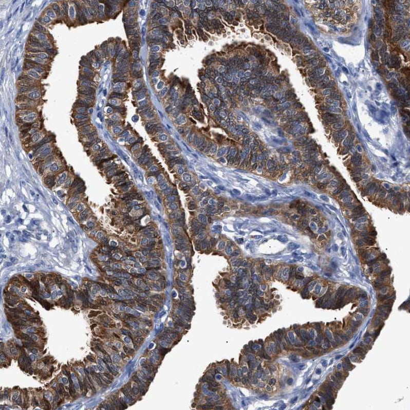 CCDC146 Antibody - BSA Free Immunohistochemistry-Paraffin: CCDC146 Antibody - BSA Free [NBP1-86433]