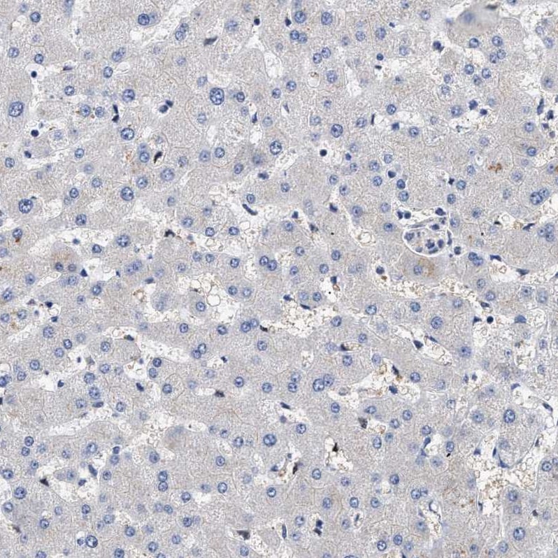 CCDC146 Antibody - BSA Free Immunohistochemistry-Paraffin: CCDC146 Antibody - BSA Free [NBP1-86433]