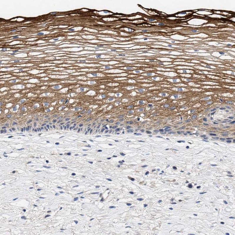 CCDC146 Antibody - BSA Free Immunohistochemistry-Paraffin: CCDC146 Antibody - BSA Free [NBP1-86433]