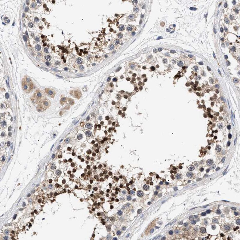 CCDC146 Antibody - BSA Free Immunohistochemistry-Paraffin: CCDC146 Antibody - BSA Free [NBP1-86433]