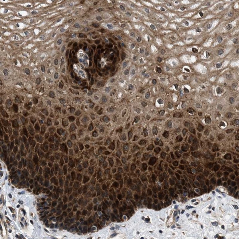 PRDM14 Antibody - BSA Free Immunohistochemistry-Paraffin: PRDM14 Antibody - BSA Free [NBP1-86437]