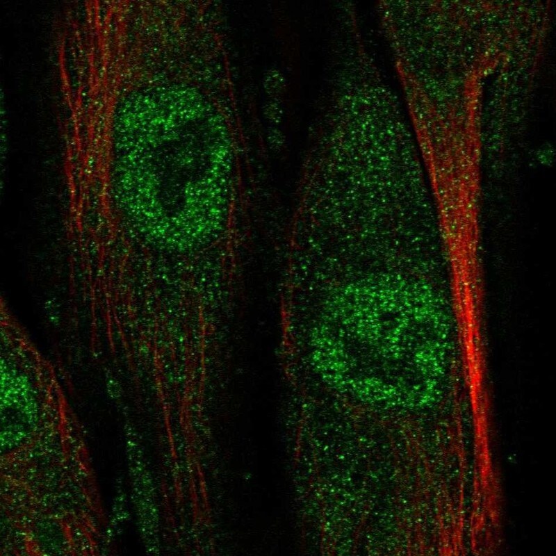NAALADase-like 2/NAALADL2 Antibody - BSA Free Immunocytochemistry/ Immunofluorescence: NAALADase-like 2/NAALADL2 Antibody [NBP1-86445]