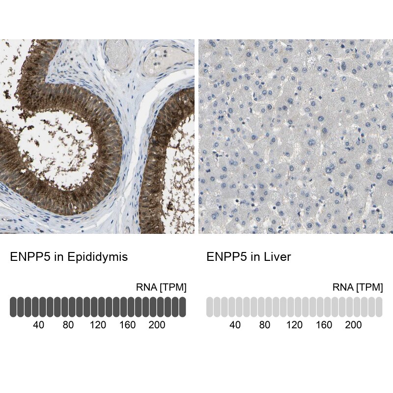 ENPP-5 Antibody - BSA Free Immunohistochemistry-Paraffin: ENPP-5 Antibody - BSA Free [NBP1-86449]