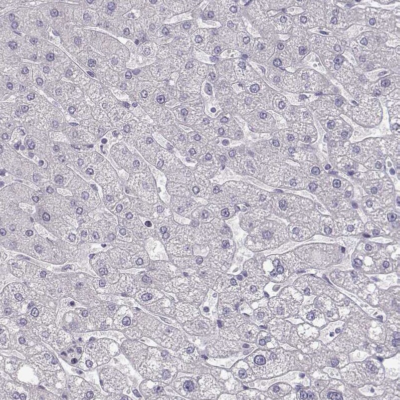 ZNF185 Antibody - BSA Free Immunohistochemistry-Paraffin: ZNF185 Antibody - BSA Free [NBP1-86452]