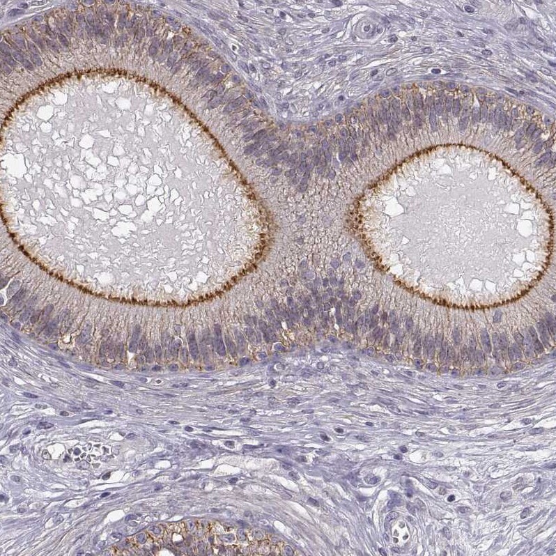 ZNF185 Antibody - BSA Free Immunohistochemistry-Paraffin: ZNF185 Antibody - BSA Free [NBP1-86452]