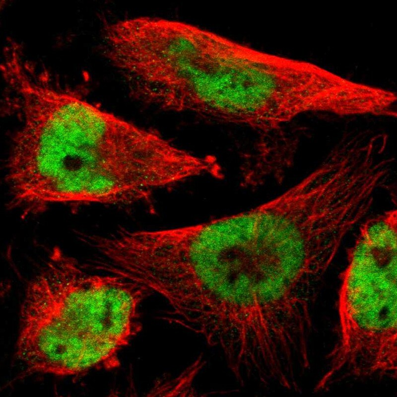 RNF38 Antibody - BSA Free Immunocytochemistry/ Immunofluorescence: RNF38 Antibody [NBP1-86453]