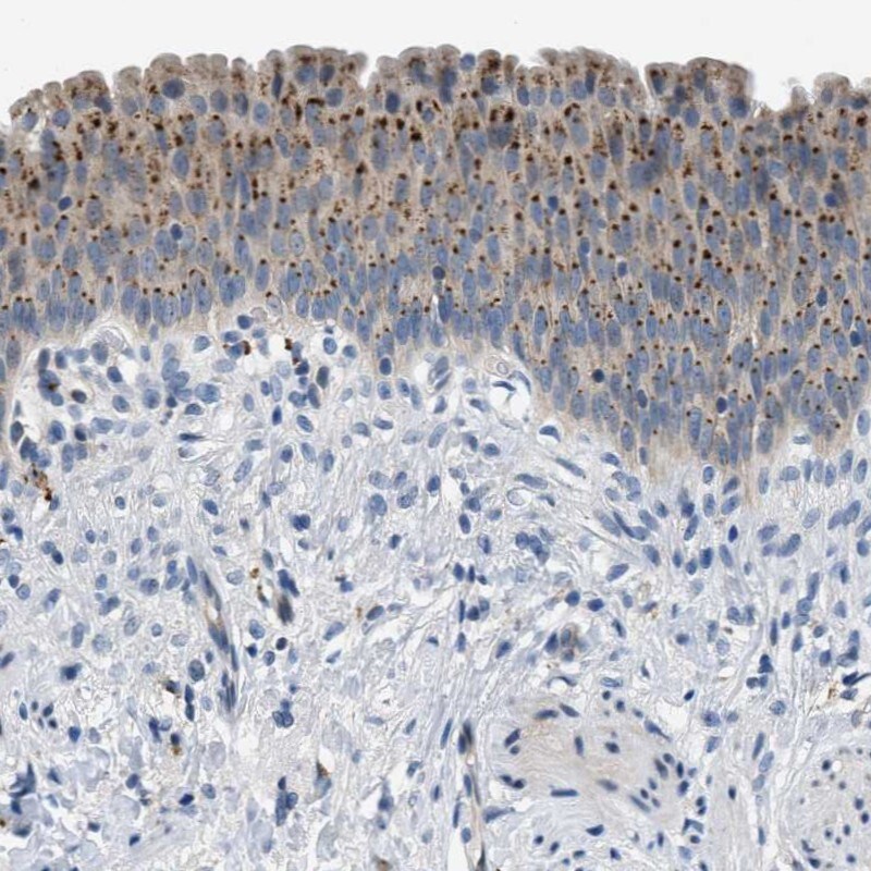 EMR3 Antibody - BSA Free Immunohistochemistry-Paraffin: EMR3 Antibody - BSA Free [NBP1-86454]