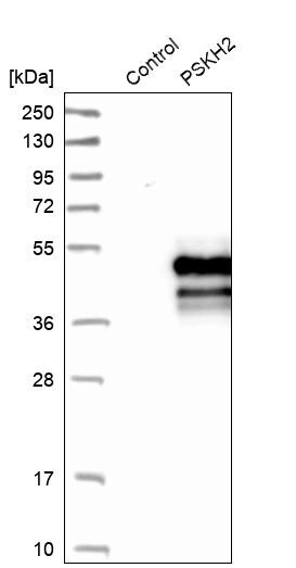 PSKH2 Antibody - BSA Free Western Blot: PSKH2 Antibody - BSA Free [NBP1-86459]