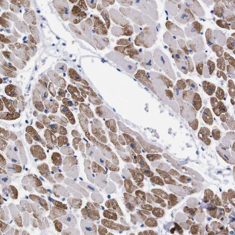 NEBL Antibody - BSA Free Immunohistochemistry: NEBL Antibody - BSA Free [NBP1-86463]