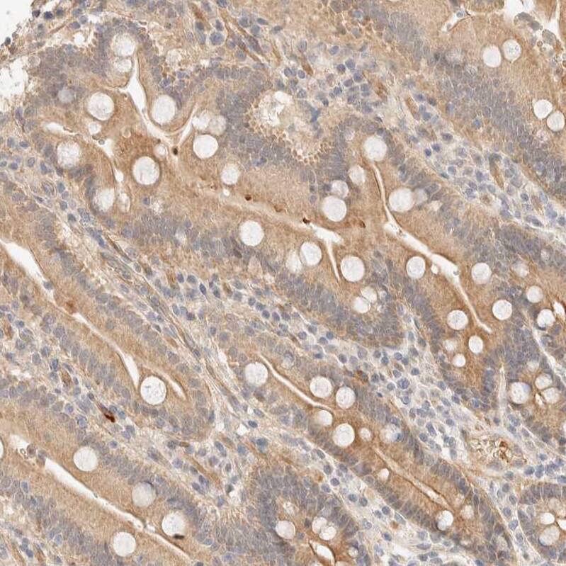 Tnk1 Antibody - BSA Free Immunohistochemistry-Paraffin: Tnk1 Antibody - BSA Free [NBP1-86477]