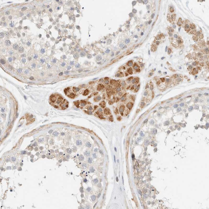 Tnk1 Antibody - BSA Free Immunohistochemistry-Paraffin: Tnk1 Antibody - BSA Free [NBP1-86477]