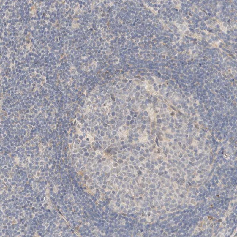 Tnk1 Antibody - BSA Free Immunohistochemistry-Paraffin: Tnk1 Antibody - BSA Free [NBP1-86477]